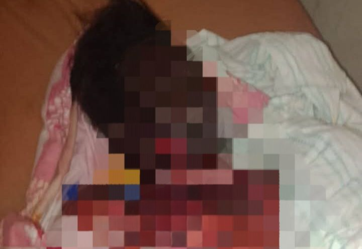 You are currently viewing Monatélé : Une mère de trois enfants brulée à mort, son conjoint indexé